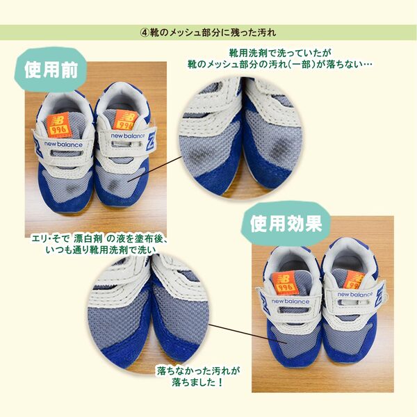  [衣料用漂白剤] [大容量] エリ･そで 漂白剤 300mLの画像